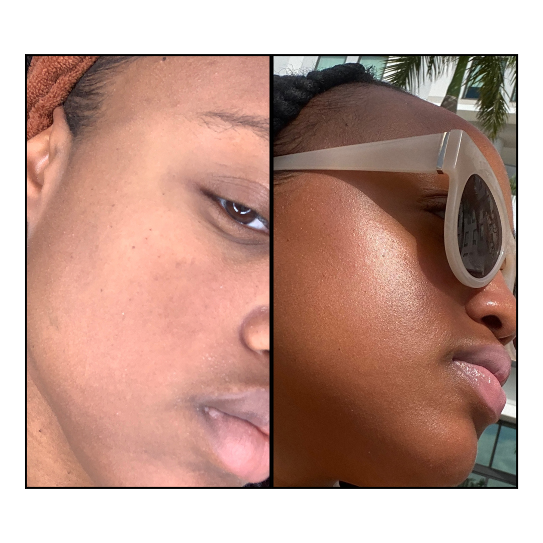 Clear Skin Bundle